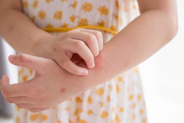 Основные причины аллергического зуда на руках