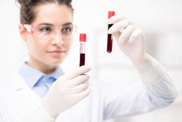 Анализ свертываемости крови: зачем нужно и как проводится
