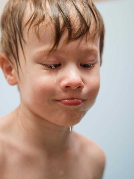 Симптомы дерматита на лице у ребенка