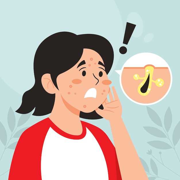 Бактериальный ринит и его связь с густой слизью в носу