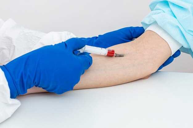 Как снизить уровень альт в крови: основные методы и рекомендации