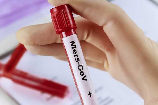 Что означает положительный результат экспресс теста на ВИЧ?
