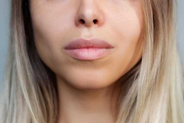 Что может вызвать отек верхней губы?