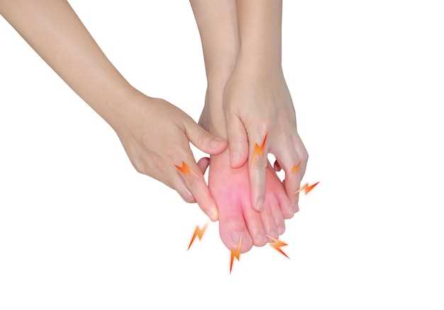 Побеление ногтей на руках: причины и лечение