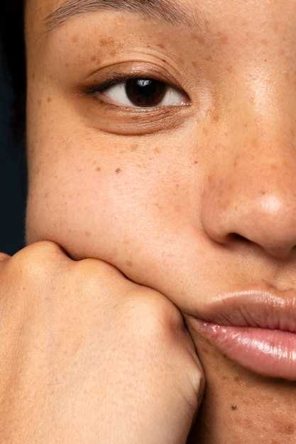Черные точки на носу: причины и способы их устранения