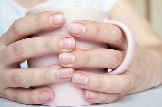 Симптомы псориаза на ногтях рук и их диагностика