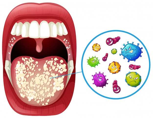 Разница между ротовирусом и кишечной инфекцией