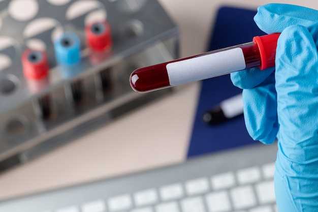 Тест на туберкулез по крови: особенности и принципы работы